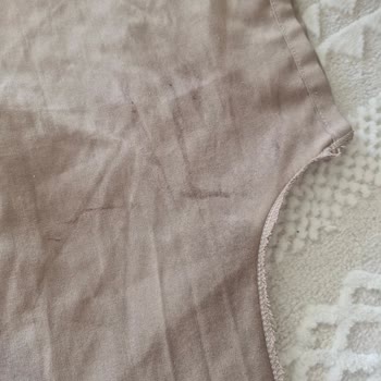 Niye Derma Control Spreyi Formalarımda Siyah Lekeler Bıraktı