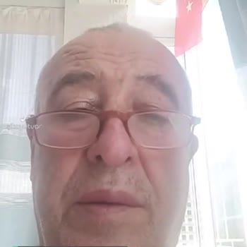 ebebek Biberon Emziği Çabuk Deforme Oldu!