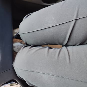 Pantolonun Dizlerinde Beyazlama Ve Müşteri Hizmetlerinin Çözüm Sunmaması