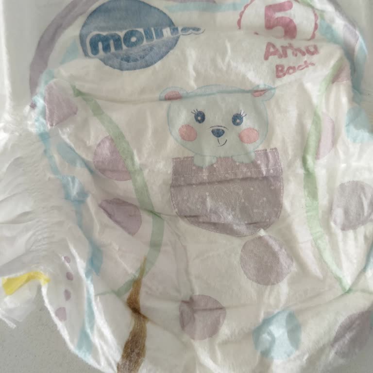 Molfix Bebek Bezinde Eksik Cırtı Ve Leke: Üretim Hatası Ve Değişim Talebi