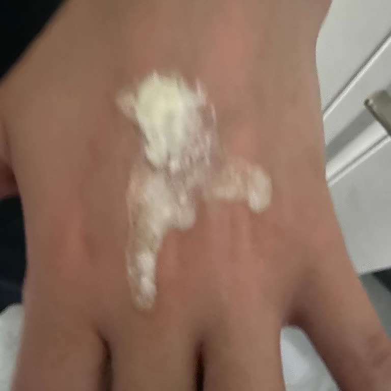Bioderma Güneş Kremi Doku Bozukluğu, Koruma Kaybı Ve Şiddetli Kızarıklık