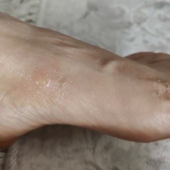 Guja Terliğinin Bir Saatte Ayağa Verdiği Şiddetli Zarar Ve Mağaza İadesi Reddi