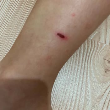 Toyas Pateni Süngeri Parçalandı, Çocuğum Yaralandı Ve İade Talep Ediyorum