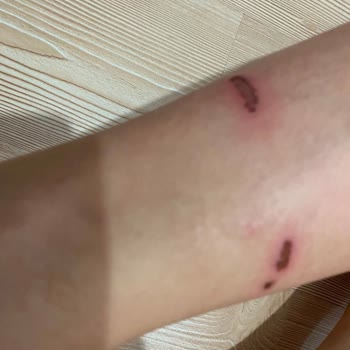 Toyas Pateni Süngeri Parçalandı, Çocuğum Yaralandı Ve İade Talep Ediyorum