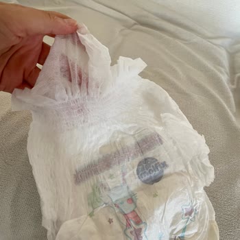 Molfix 4 Numaralı Külot Bezinde Sızdırma Ve Aşırı Elastik Sorunu