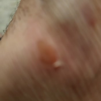 İnci Ayakkabı Üst Bantları Ayağını Vurup Kullanılamaz Hale Getiren Terlik İçin İade Talebi