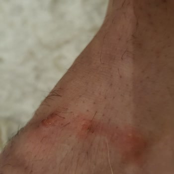 İnci Ayakkabı Üst Bantları Ayağını Vurup Kullanılamaz Hale Getiren Terlik İçin İade Talebi