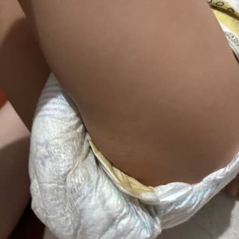 Molfix Bebek Bezinde Sızdırma Ve Kötü Koku