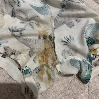Molfix Bebek Bezinde Sızdırma Ve Kötü Koku