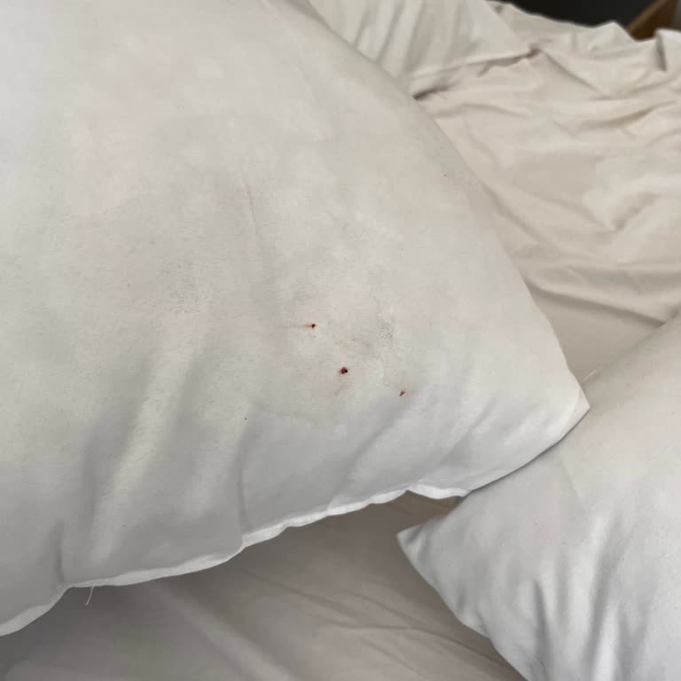 Yasmin Bodrum Resort’ta Kalitesiz Konaklama Ve Haksız Kesinti