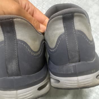 Skechers Erkek Ayakkabısında Kısa Sürede Renk Değişimi Ve Kırılma Sorunu