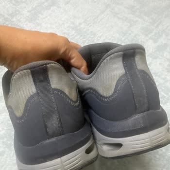 Skechers Erkek Ayakkabısında Kısa Sürede Renk Değişimi Ve Kırılma Sorunu