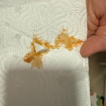 İskender Siparişinde Kırık Porselen Parçası Bulunması Sağlık Tehlikesi