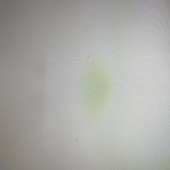 Vestel Televizyonundaki Servis Sonrası Yeni Ekran Problemleri Ve Değişim Talebi
