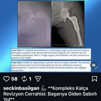 Kalça Protezi Dislokasyonu Sonrası Sosyal Medyada Başarı İddiasına Karşı Şikayet