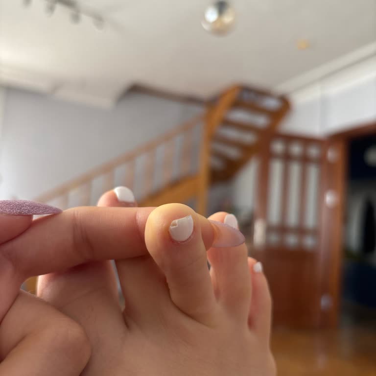 Perla Nail Beauty Kirpiklerim Teker Teker Dökülerek Şu An Çok Kötü Bir Hale Geldi
