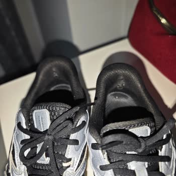 Skechers Ayakkabısında 20 Gün İçinde Yırtılma Ve Ayak Yaralanması, Değişim Talebi Reddedildi