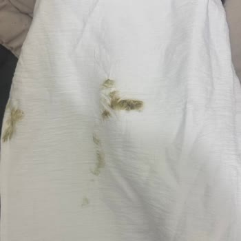 Temiz Gönderdiğim Pantolon Lekeli Şekilde Geri Geldi Ve İade Reddiyle Mağdur Oldum