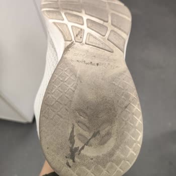 Skechers Ayakkabısının Kaygan Tabanı Nedeniyle Düşme Ve Diz Yaralanması