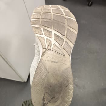 Skechers Ayakkabısının Kaygan Tabanı Nedeniyle Düşme Ve Diz Yaralanması