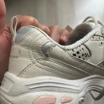 Skechers Ayakkabısının Kısa Sürede Yırtılması Ve Ücret İadesi Talebi