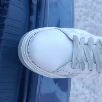Üç Ay Sonra Açılan Ve Yırtılan Zara Spor Ayakkabıda Kalite Hayal Kırıklığı
