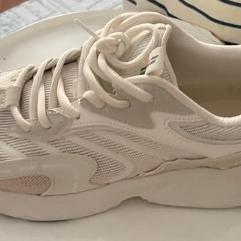 Skechers Ayakkabısında Erken Taban Ayrılması Ve Şirketin Haksız Red Cevabı