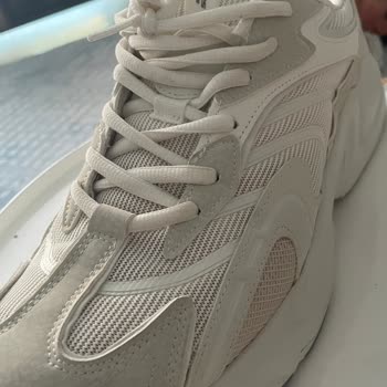 Skechers Ayakkabısında Erken Taban Ayrılması Ve Şirketin Haksız Red Cevabı