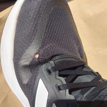 Adidas Ayakkabısının Dikişlerinin Açılması Ve Kullanıcı Hatası İddiası