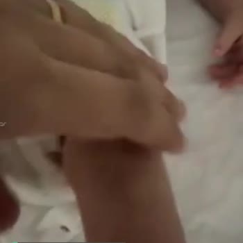 Prima Bebek Bezimin Sızdırması