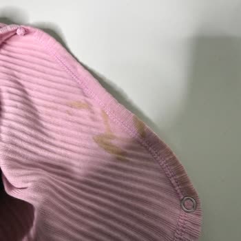 Bacak Kenarlarından Sürekli Sızdırma Ve Hijyen Sorunu
