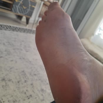 Ayak Boyayan Sandalet İçin Hızlı Ürün Değişimi Talebi