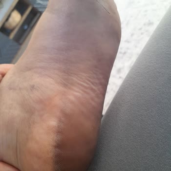 Ayak Boyayan Sandalet İçin Hızlı Ürün Değişimi Talebi