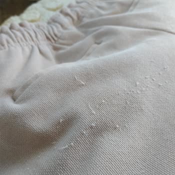 Brango Pantolonunun Tek Kullanımda Pamuklanması Ve Müşteri Hizmetleri Erişilememesi
