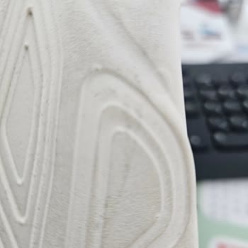 Ayıplı Ürün Ve Geciken 5.803 TL İadesi