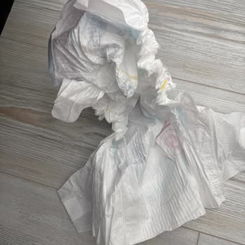 Molfix Bebek Bezlerinde Süngersiz Boş Ürünler Mağduriyete Neden Oluyor