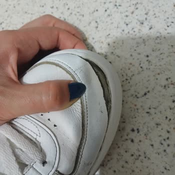 Skechers Ayakkabısı İki Ayda Açıldı, Değişim Talebi Reddi