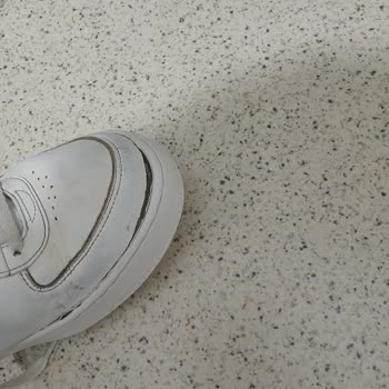 Skechers Ayakkabısı İki Ayda Açıldı, Değişim Talebi Reddi