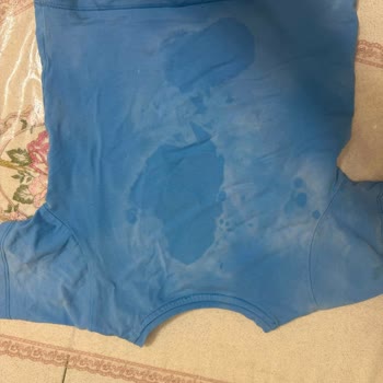 Rossmann’dan Alınan Domol Leke Çıkarıcı Kıyafetleri Yakarak Zarar Verdi