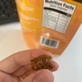 Seed'n Grains Hem Hijyen Açısından Hem De Sağlık Açısından Beni Ciddi Şekilde Rahatsız Etti