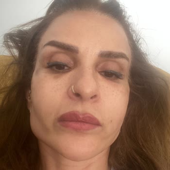 Yetkisiz Botoks Ve Dolgu Sonrası Şiddetli Sağlık Problemleri Ve Ücret İadesi Talebi
