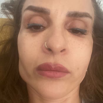 Yetkisiz Botoks Ve Dolgu Sonrası Şiddetli Sağlık Problemleri Ve Ücret İadesi Talebi