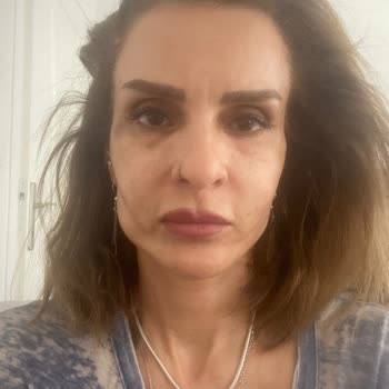 Yetkisiz Botoks Ve Dolgu Sonrası Şiddetli Sağlık Problemleri Ve Ücret İadesi Talebi