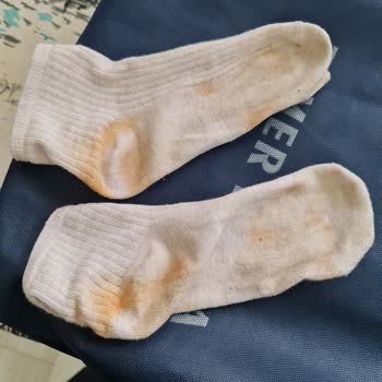 Tamer Tanca Deri Ayakkabı Çorapları Turuncuya Boyuyor, Ayıplı Ürün İadesi Gerekiyor