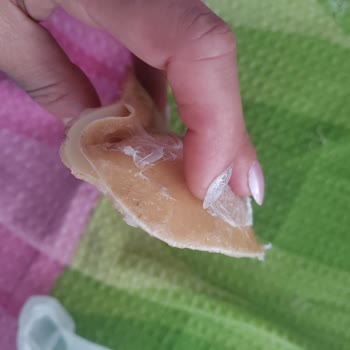 Çift Taraflı Yapışkanlı Göğüs Pedi Ürününde Aşırı Yapışkan Kalıntı Ve İade Talebi