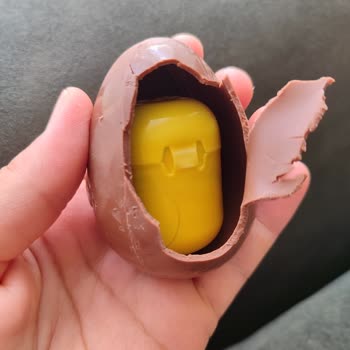 Ozmo Sürpriz Yumurtada Saç Kılı Bulunması Hijyen İhlali Ve Güven Kırılması