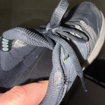 Skechers Ayakkabısında Kısa Sürede Dikiş Yırtılması Ve Amazon’un Garantisiz Cevabı