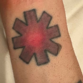 Lazer Epilasyonunda Dövme Üzerine Yanık Ve Kalıcı İz; Klinik Sorumluluk Reddi Ve Ücret İadesi Talebi