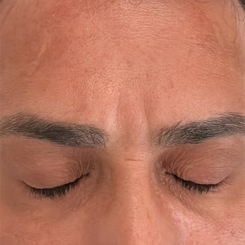 Moonqueen Merkezinde Verilen Vaatlerin Yerine Getirilmemesi Ve 72 Bin TL İade Talebi