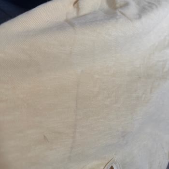 Zara'dan Eksik Ve Hasarlı Ürün Teslimatı, Müşteri Hizmetleri Yanıt Vermiyor